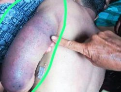 Keluarga Belum Tau Penyebab Kematian RF